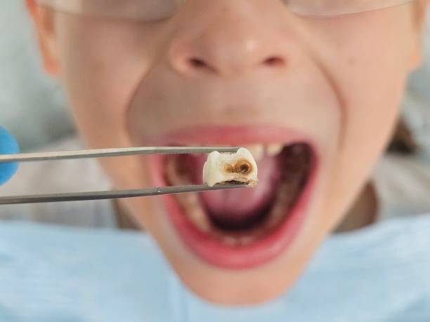Best Walk-In Emergency Dental Services in Fairview, NC
